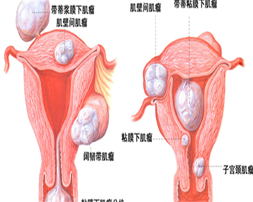 辅助生殖科普