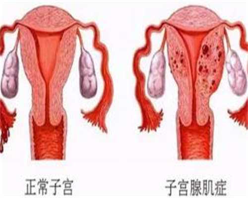 辅助生殖科普
